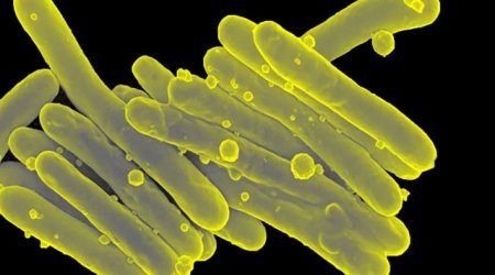 2022_06_09_mycobacterium_tuberculosistb_3_nih.jpg