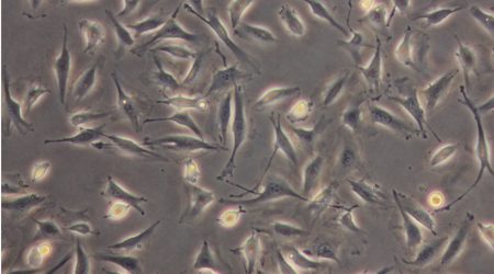 Endothelial_cells_pillars.jpg