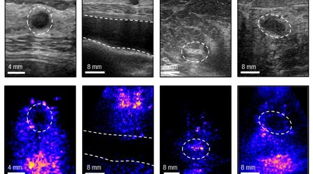MIT-CancerUltrasound-01-press_0.jpg