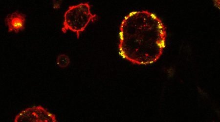 dendritic-cells.jpg