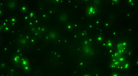 lipofuscin-720x405.webp.webp