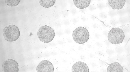 stem-cell-model-of-human-embryo-produces-yolk-sac-without-hypoblasts-or-genetic-trickery-colonies.jp_.jpeg